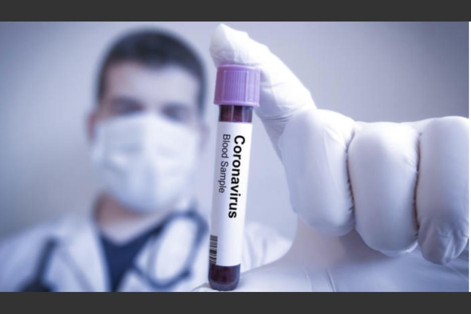 Los países que han realizado pruebas masivas del nuevo coronavirus son los que han podido combatir más eficazmente la pandemia. (Foto: Shutterstock)