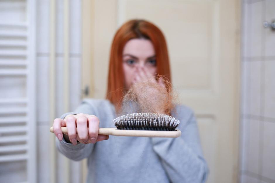 La cuarentena puede provocar caída del cabello. (Foto: Pixabay)