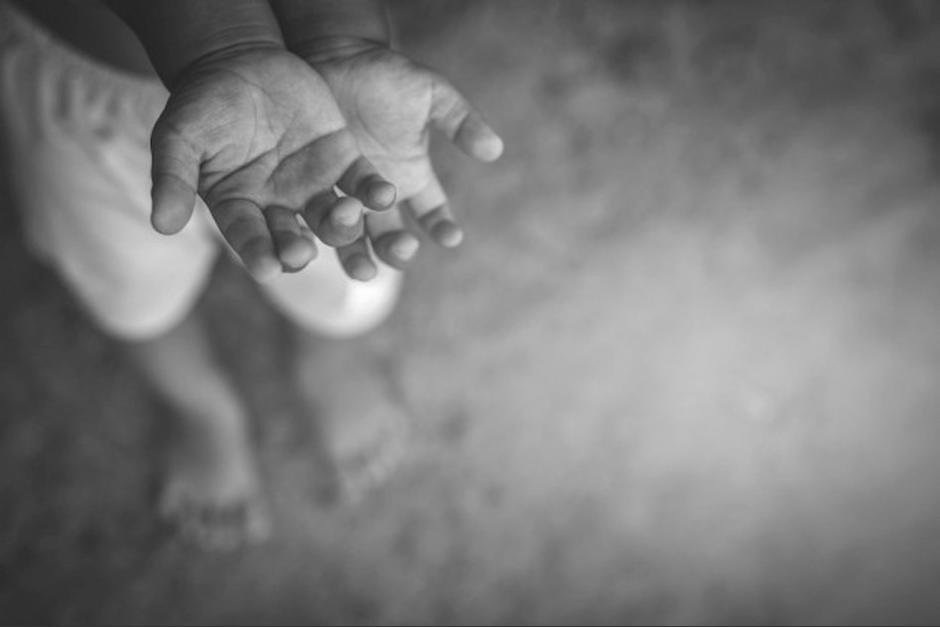 De enero a agosto de este año, murieron 13 personas por desnutrición en Guatemala. (Foto: Archivo/Soy502)&nbsp;