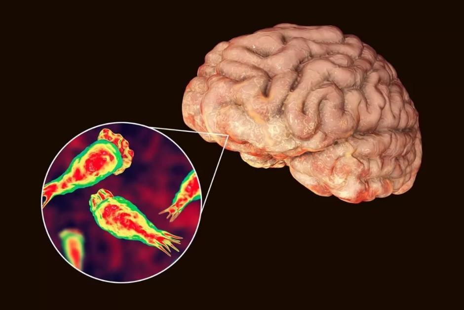 La ameba "come cerebros" provoca una infección mortal. (Foto con fines ilustrativos / Shutterstock / ElFinanciero.com.mex )&nbsp;