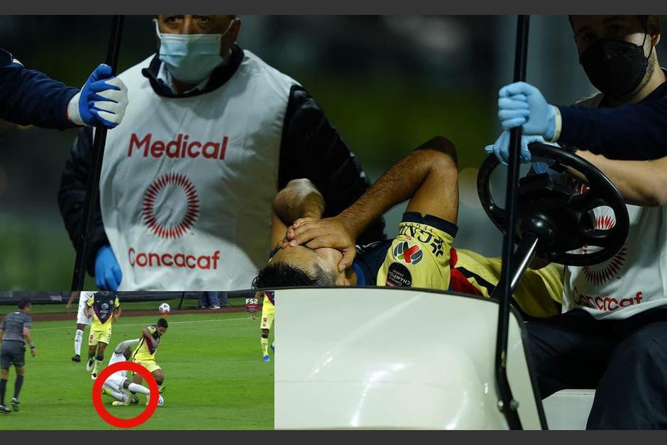 El jugador del Am&eacute;rica y de la Selecci&oacute;n de Guatemala sali&oacute; directo al hospital. (Foto: Iamgo7)
