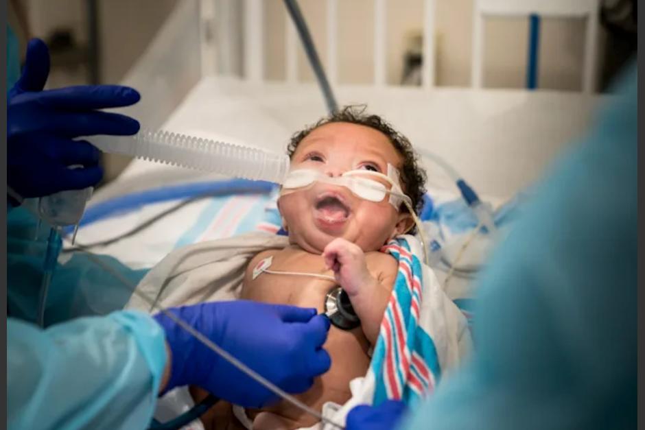 Un hospital infantil enfrenta una ola de pacientes contagiados con Covid-19 que luchan por respirar. (Foto: New York Times)