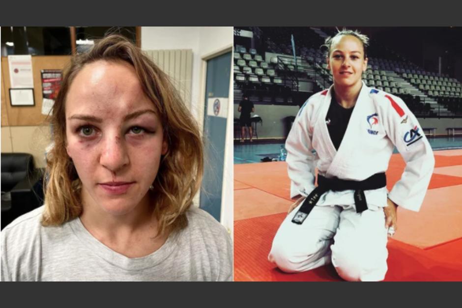 La judoca francesa result&oacute; con fuertes golpes en el rostro y la nariz fracturada. (Foto: redes sociales)