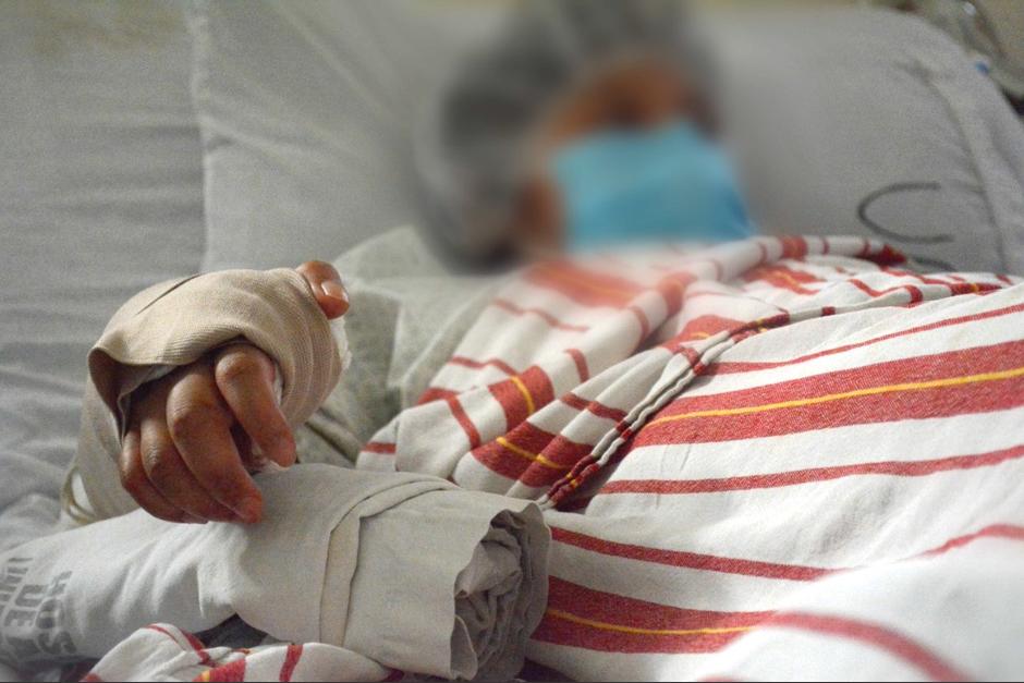 Una joven de San Marcos sufrió un grave accidente que le destruyó la mano, pero médicos lograron reconstruírsela. (Foto: MSPAS)