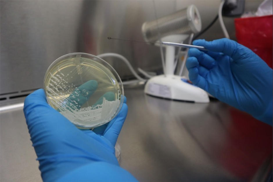 El Ministerio de Salud señaló que no han detectado más casos. (Foto: Ministerio de Salud)