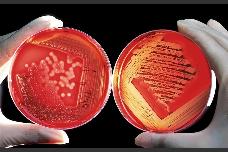 Estados Unidos report&oacute; la propagaci&oacute;n del hongo Candida auris en hospitales y asilos. (Foto: Pixabay)