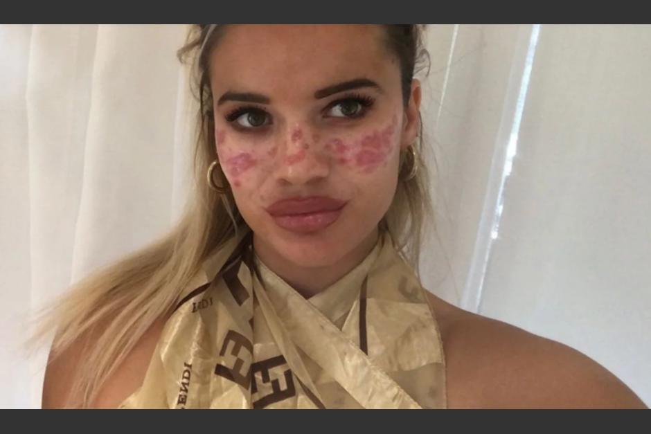 La joven alarm&oacute; a sus seguidores sobre este hecho. (Foto: captura pantalla)&nbsp;