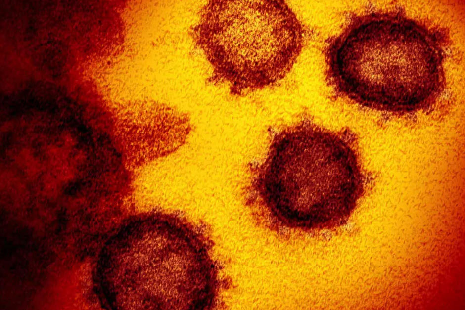 El Ministerio de Salud emitió una alerta epidemiológica tras detectar tres variantes del Covid-19. (Foto: AFP)&nbsp;