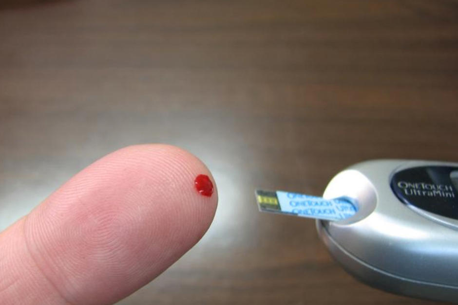 El estudio cient&iacute;fico revela las probabilidades de riesgo seg&uacute;n la gravedad del Covid-19. (Foto: Pixabay)