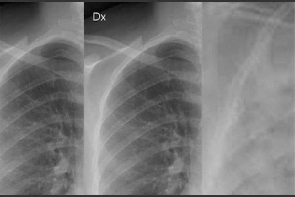 El médico muestra rayos X de pacientes con covid. (Foto: twitter)