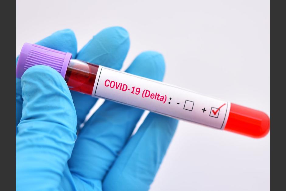 La variante Delta comienza a ser la predominante en Guatemala. (Foto: Shutterstock)