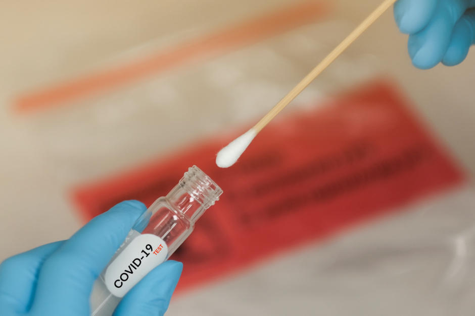 IGSS tambi&eacute;n brinda el servicio de detecci&oacute;n del Covid-19. (Foto: Shutterstock)