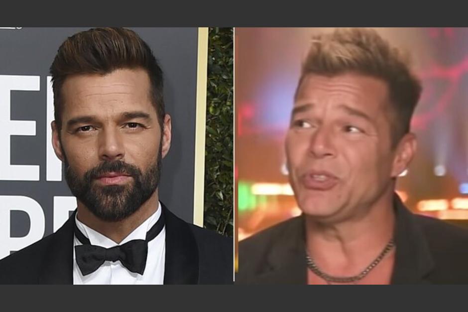 El cantante ha vuelto a los escenarios, pero su aspecto parece haber cambiado con algunos retoques. (Foto: Radio Fórmula)