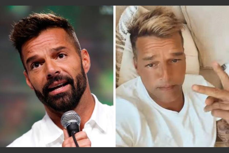 A través de un comunicado&nbsp;se dijo que el cantante tuvo una reacción alérgica. (Foto: Instagram)