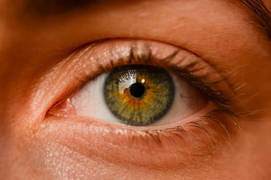La infección de ojos se puede incrementar en verano. (Foto ilustrativa / Pixabay )&nbsp;