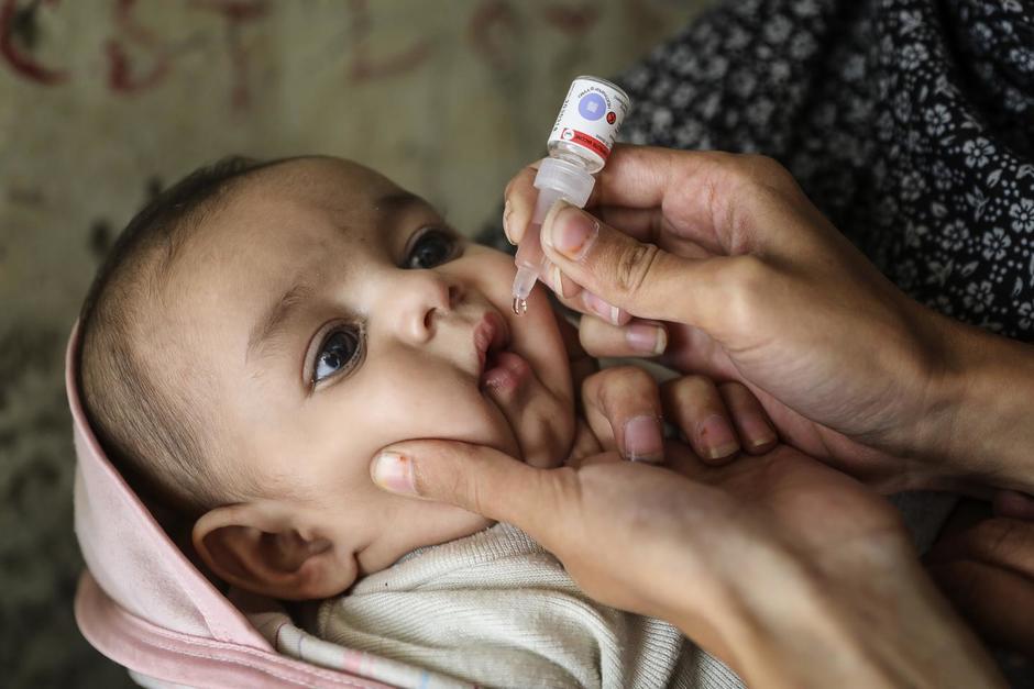 La poliomielitis se puede prevenir con vacunación. (Foto: Unicef)