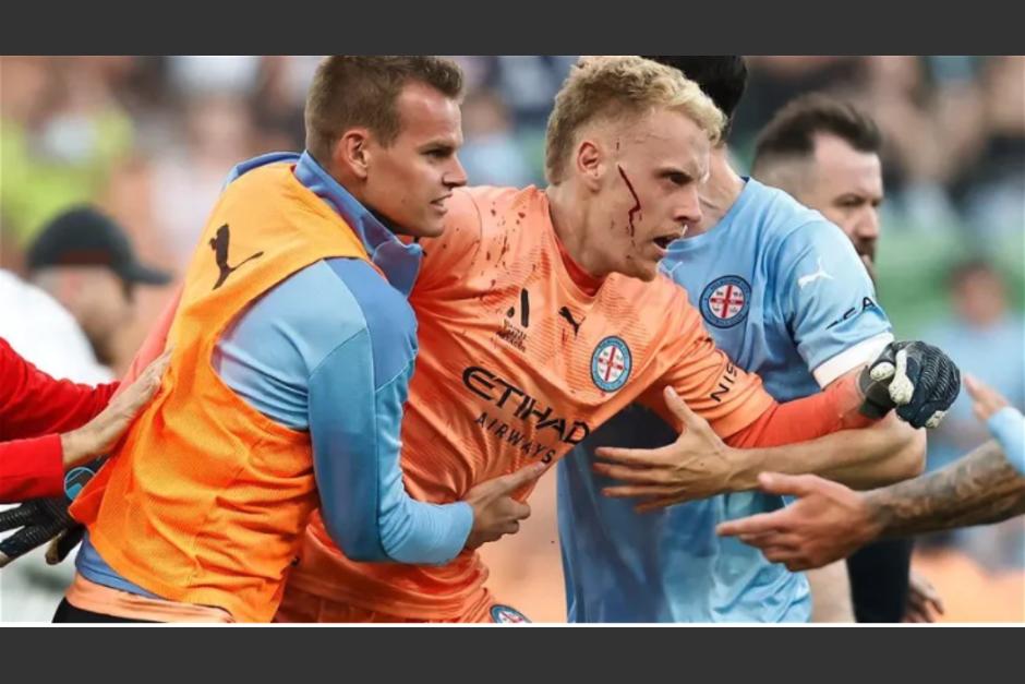 El guardameta fue asistido tras recibir el impacto en la cara. (Foto: EuroWeekly)