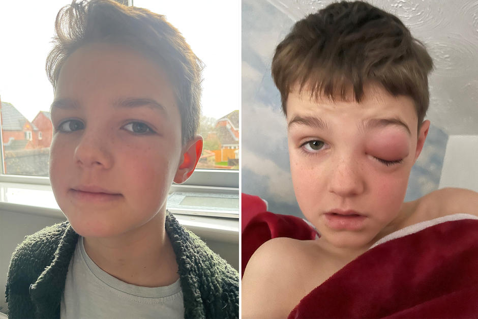 Zack Morey pas&oacute; la navidad en un hospital tras tener complicaciones por el Covid-19. (Foto: Angela Morey)