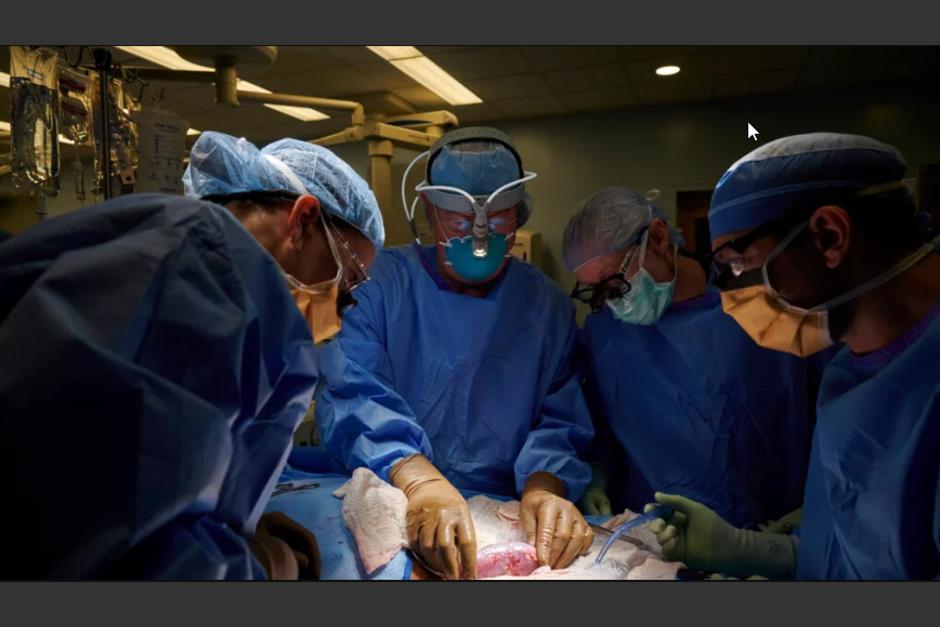 Un equipo de cirujanos estadounidenses trasplant&oacute; con &eacute;xito el coraz&oacute;n de un cerdo modificado gen&eacute;ticamente a un humano; una primicia mundial, inform&oacute; la universidad Maryland Medical School. (Foto:&nbsp;www.wfla.com)
