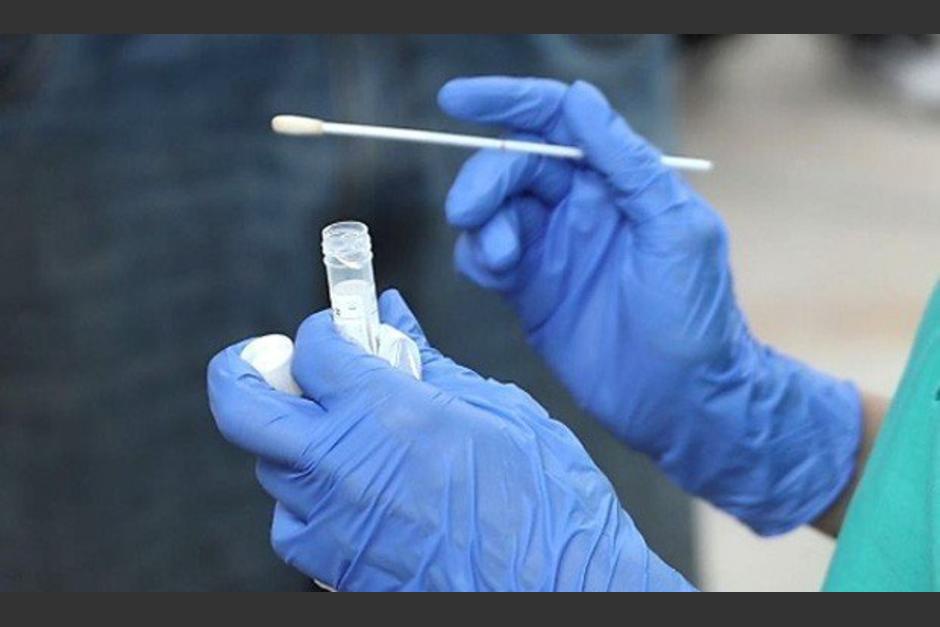 Las pruebas que son realizadas para detectar el Covid-19 son de ant&iacute;genos. (Foto: Redacci&oacute;n m&eacute;dica)&nbsp;