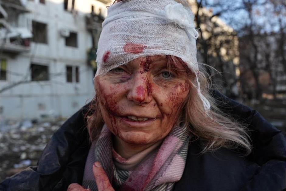 Olena Kurilo sobrevivi&oacute; a un ataque de misil ruso. (Foto: Sky News)