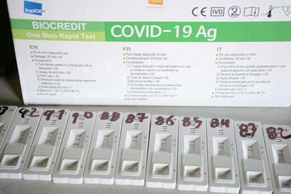 Las pruebas de antígenos son rápidas y fáciles de usar en casa. (Foto: archivo/Soy502)