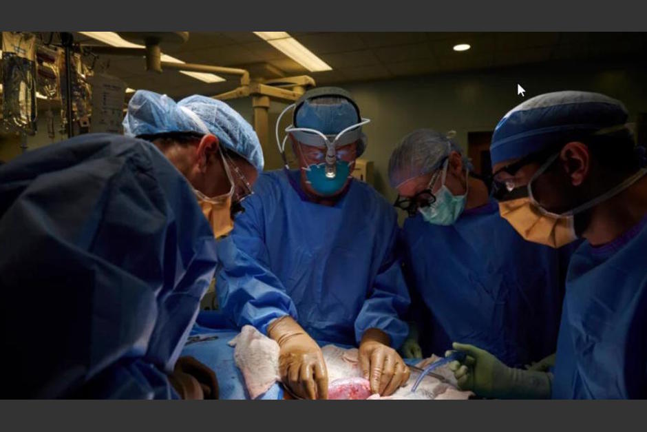 La primera persona que recibi&oacute; un trasplante de coraz&oacute;n de cerdo muri&oacute; dos meses despu&eacute;s del procedimiento hist&oacute;rico en Estados Unidos. (Foto: www.fla.com)