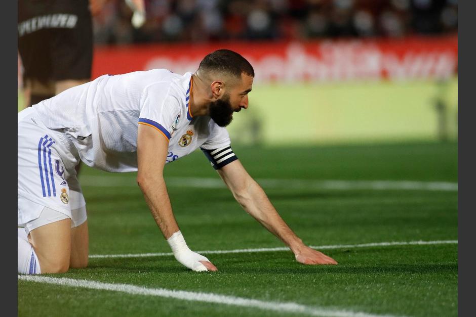 El jugador franc&eacute;s marc&oacute; un doblete, pero se fue lesionado antes de terminar el partido. (Foto: AFP)