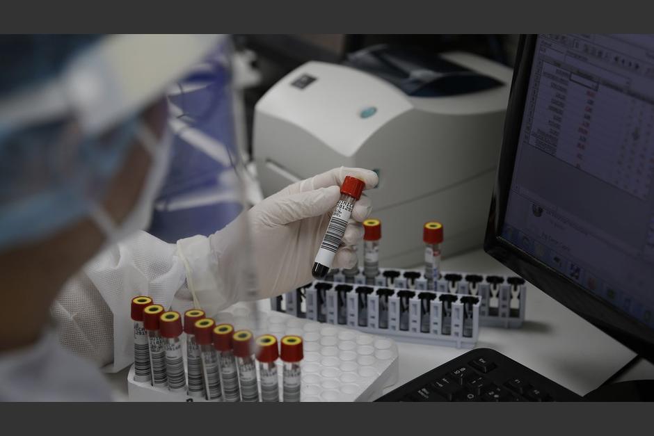 Vista microsc&oacute;pica de la viruela del Mono. (Foto: archivo/Soy502)