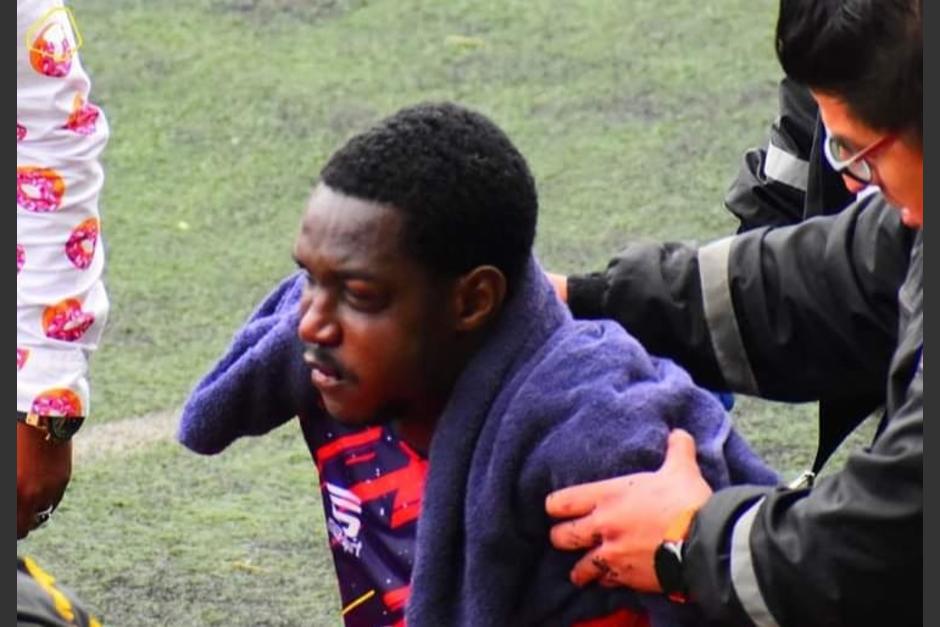 Igor Dos Santos, jugador de San Pedro sufrió 7 fracturas en el rostro. (Foto: Facebook Canal Cuatro)