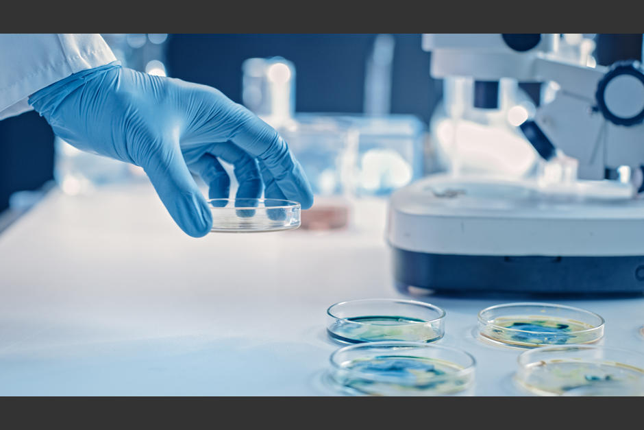 Los hallazgos sobre la c&eacute;lula maligna que se desprenden del c&aacute;ncer de colon fueron hechos por un grupo de investigadores de Europa. (Foto ilustrativa: Esteve.org)