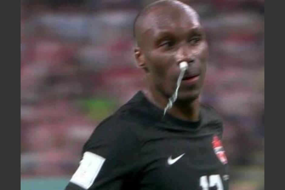 Atiba Hutchinson, jugador Canadá jugó con un tampón debido a una hemorragia. (Foto: Captura de pantalla)