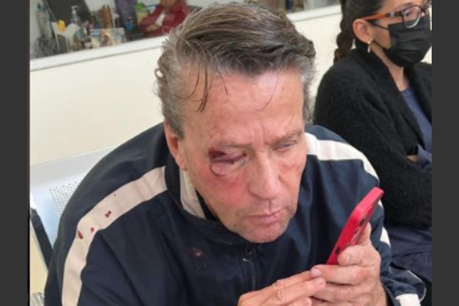 Alfredo Adame fue sometido a una cirugía tras una grave golpiza. (Foto: Instagram)