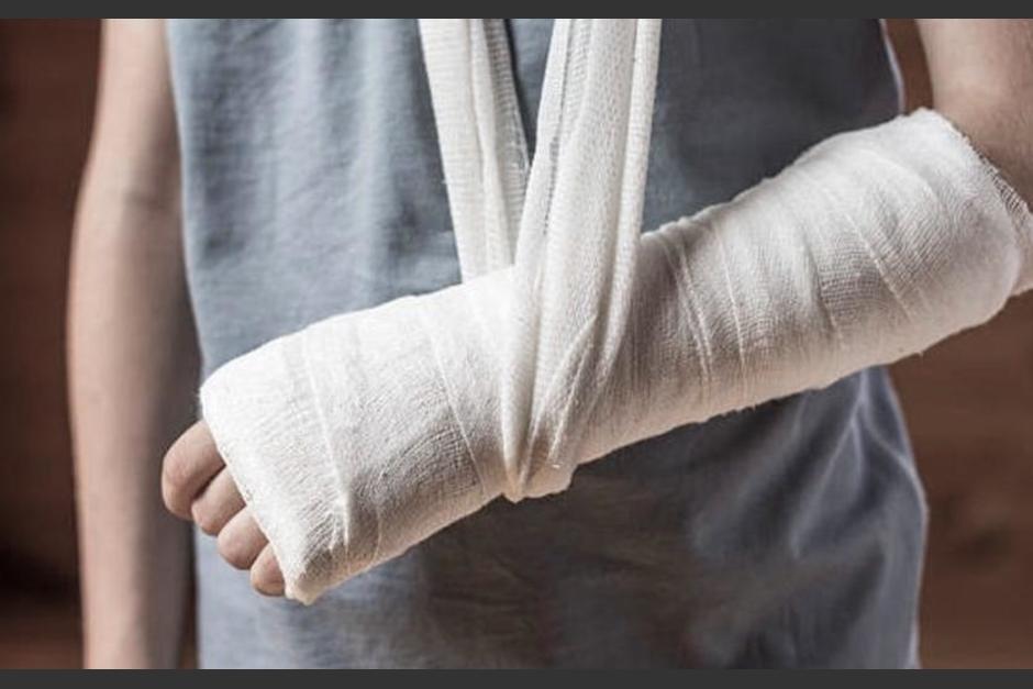 Un niño sufrió una fractura al ser golpeado por un hombre. (Foto: Shutterstock)