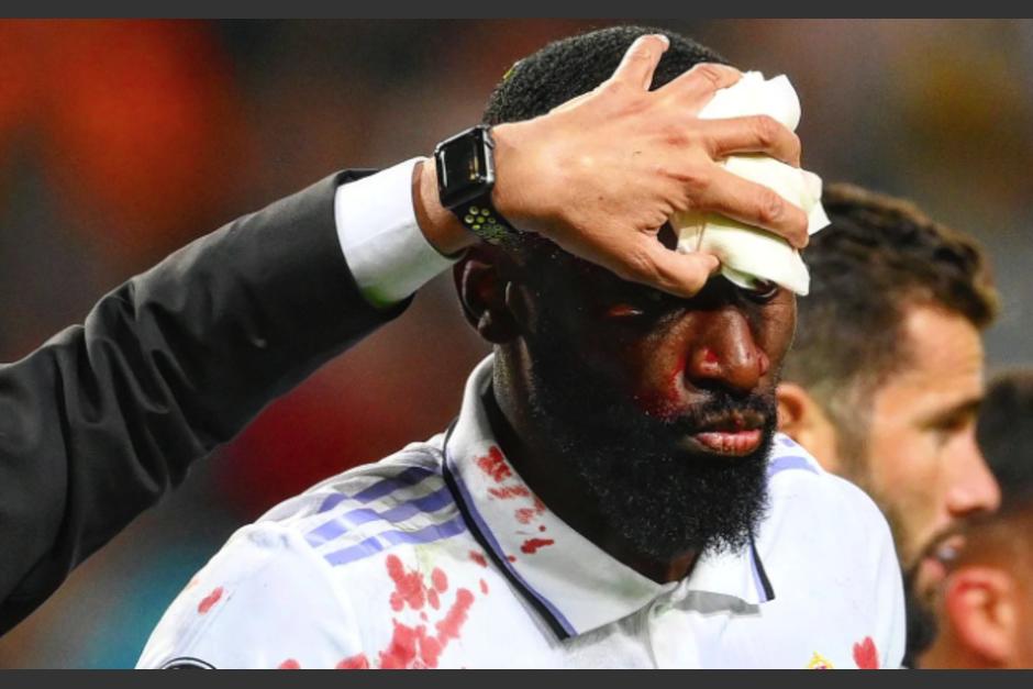 Antonio R&uuml;diger se lesion&oacute; tras anotar un gol de cabezazo ante el Shakhtar. (Foto: Instagram)