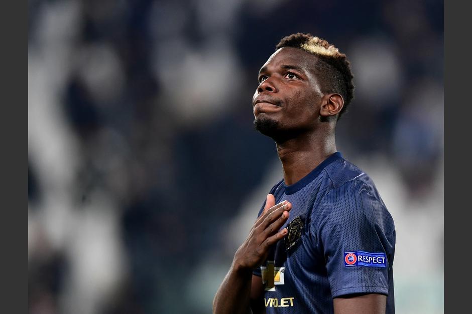 El internacional francés Paul Pogba, lesionado, causa baja para el Mundial. (Foto: AFP)