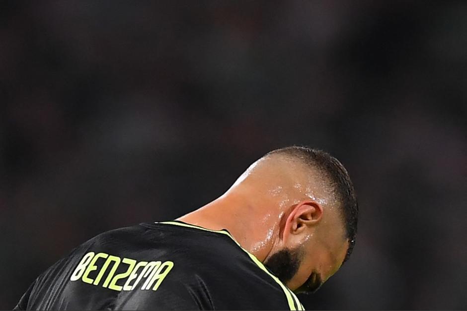 Benzema sufre una lesión muscular y una sobrecarga. (Foto: AFP)&nbsp;