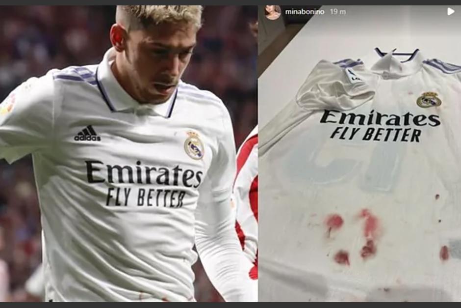La camisa de Valverde termin&oacute; con manchas de sangre tras el derbi ante el Atl&eacute;tico. (Foto: Redes sociales)