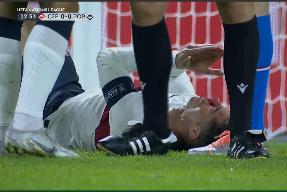 El capit&aacute;n de Portugal se ha visto mermado por el golpe que recibi&oacute; tras chocar con el guardameta checo. (Captura Video)