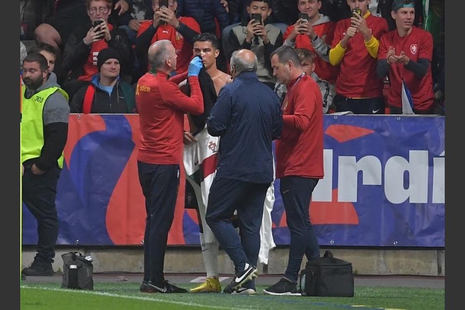 El portugu&eacute;s fue atendido despu&eacute;s de recibir el fuerte golpe en la cara. (Foto: AFP)