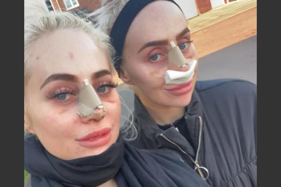 Ellas son Dolly y Daisy Simpson, las gemelas que pagaron&nbsp;200 mil euros para parecerse a Barbie. (Foto: MD)