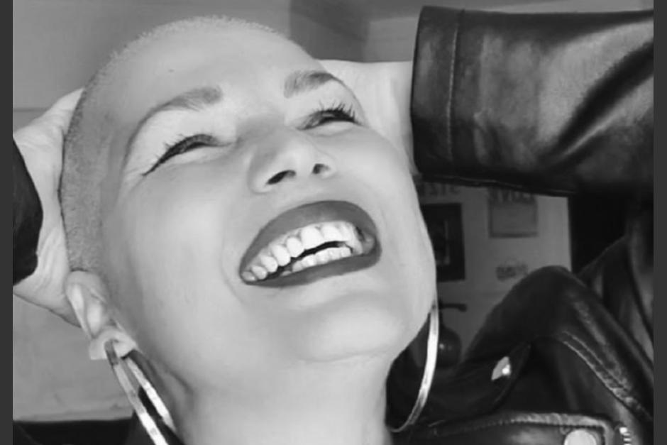 La tiktoker Hilda Siverio falleci&oacute; tras una larga lucha contra el c&aacute;ncer. (Foto: ABC)