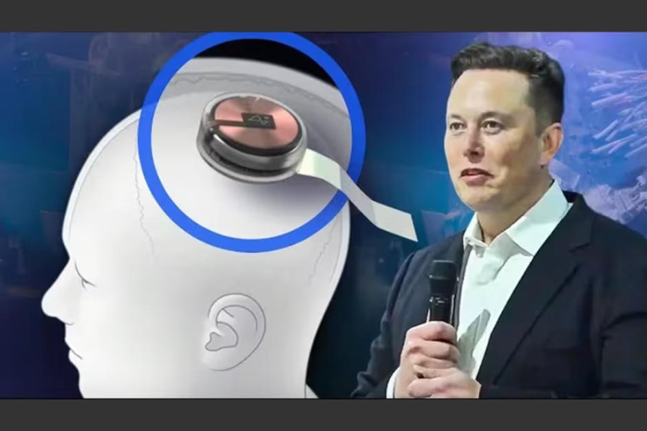 El magnate Elon&nbsp;Musk. (Foto: Neuralink)