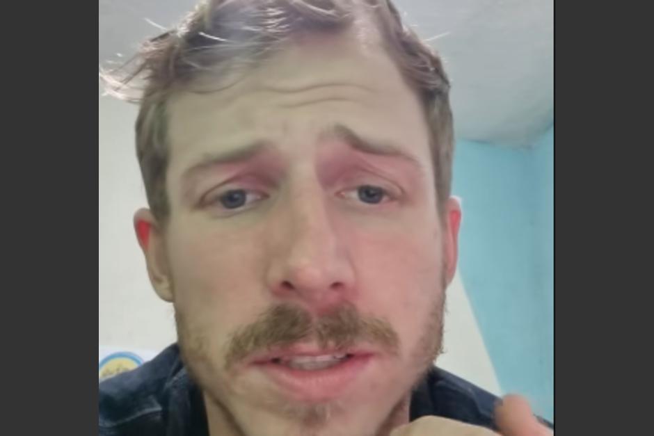 El canadiense mostró todas la heridas que tiene en su cuerpo. (Foto: Captura de video)