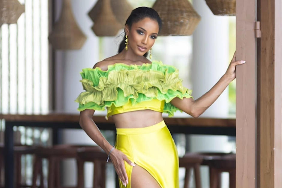 Miss Jamaica sigue delicada. (Foto: oficial)