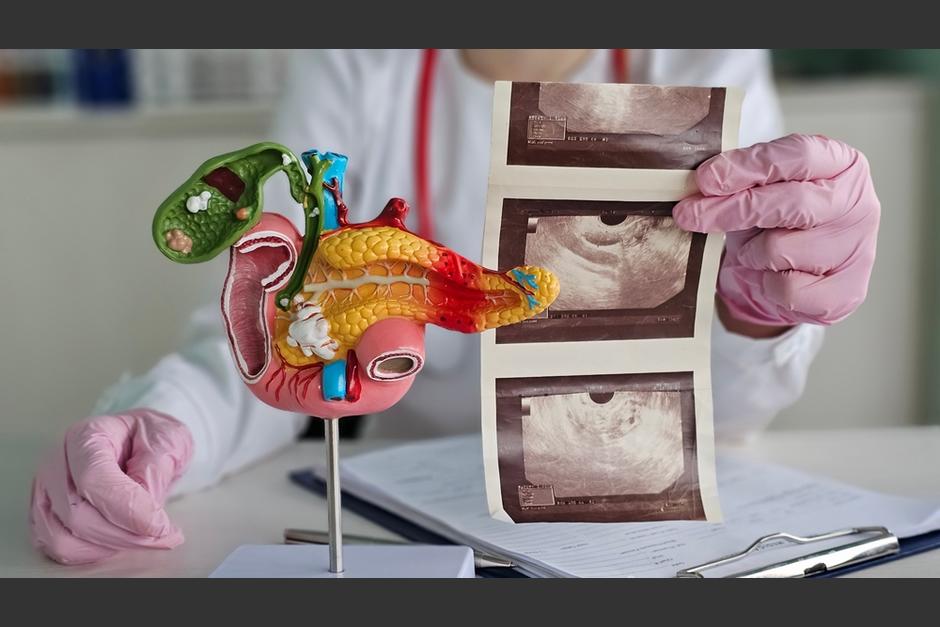 La mitad de los pacientes que lo tomaron sobrevivieron m&aacute;s de 13 meses. (Foto: Shuttestock)