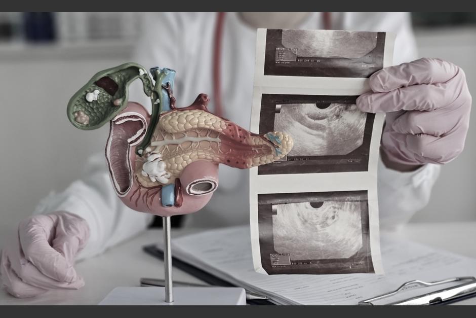 La mitad de los pacientes que lo tomaron sobrevivieron m&aacute;s de 13 meses. (Foto: Shuttestock)