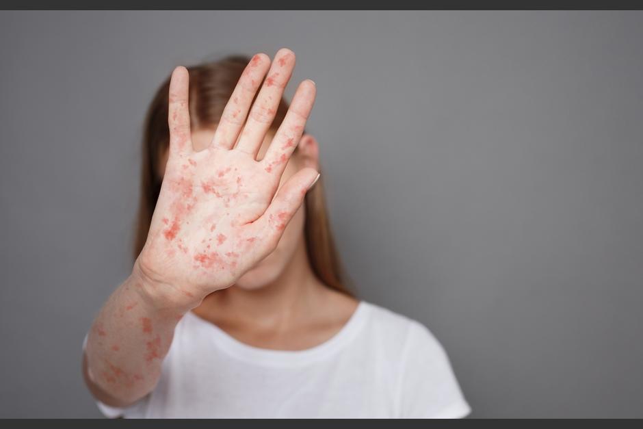 La muestra fue enviada al laboratorio nacional. (Foto: Shutterstcok)