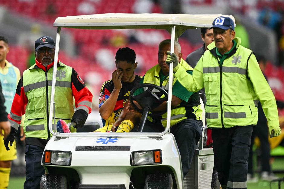 El defensa uruguayo del Am&eacute;rica, Sebasti&aacute;n C&aacute;ceres, fue retirado del campo durante el partido de ida de los cuartos de final del Torneo Clausura de la Liga Mexicana.