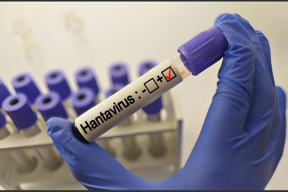 Tres personas con hantavirus han fallecido. (Foto: Shutterstock)